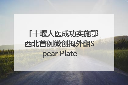 十堰人医成功实施鄂西北首例微创拇外翻Spear Plate髓内板矫形术